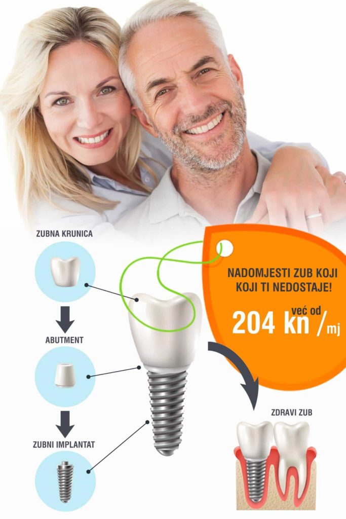 zubni implantati u zagrebu